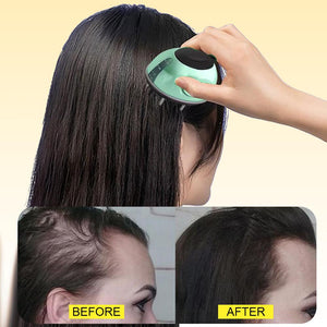 Hair Growth Serum Kit Product. Anti-Hair Loss Treatment single - ALDY Care Shop